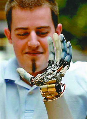 克里斯蒂安的“仿生臂”