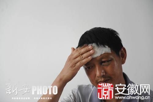汪师傅回忆起当时一幕,称感到很恐惧,他自己现在头部和身上多处受伤。